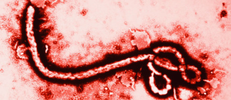 Ebolaviruset.