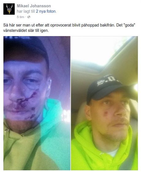 SOO-talesmannen Mikael Johansson efter överfallet. FOTO: Facebook